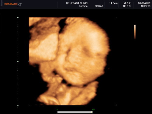 30week ท้องแรก