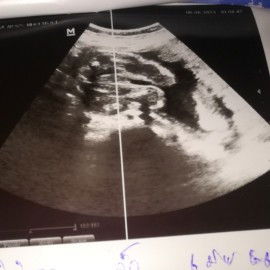 แม่ๆช่วยดูเพศน้องหน่อยค่ะว่าน้องเป็นผู้หญิงหรือผู้ชาย