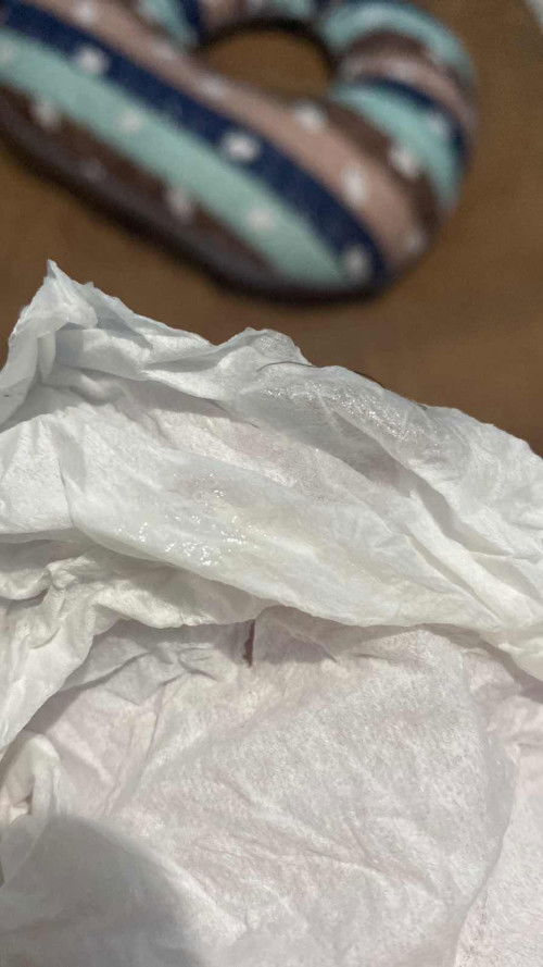 Keluar lendir bening