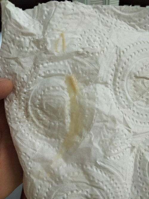 แบบนี้ควรไปหาหมอไหมคะ37+6