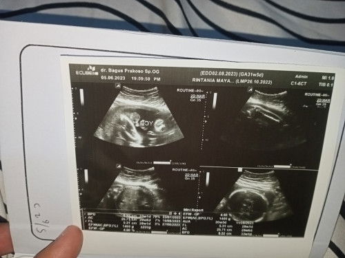 Berat badan janin pas USG