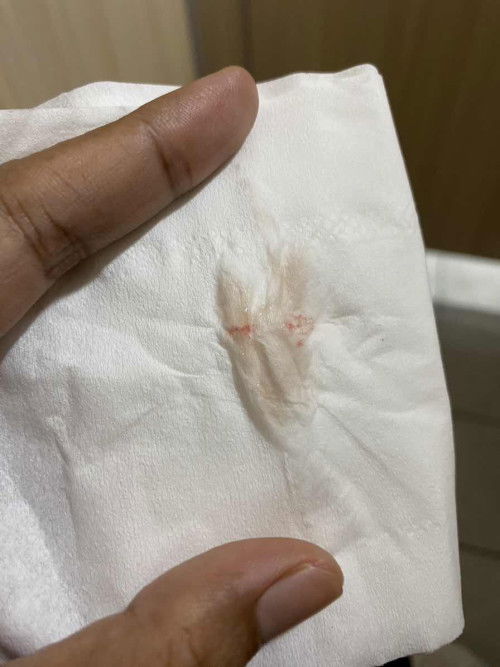 Boleh nanya ngga ini haid atau bukan?