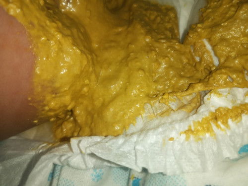 เเบบนี้เรียกว่าอึเเข็งไหมคะ