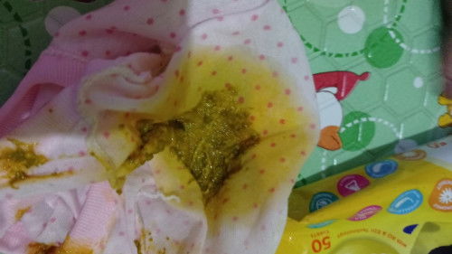 Pup bayi 1 bulan lebih dari 8x, bun adakah yg sama? Aman ngga ya