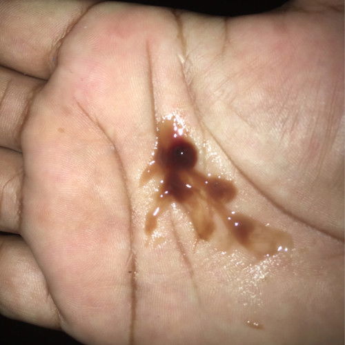 แบบนี้อันตรายไหมค่ะ ออกมาเมื่อเช้า?