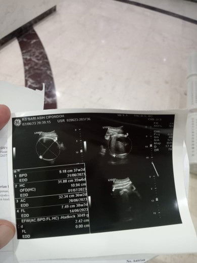 Udah bulannya kok belum lahir juga sih?!