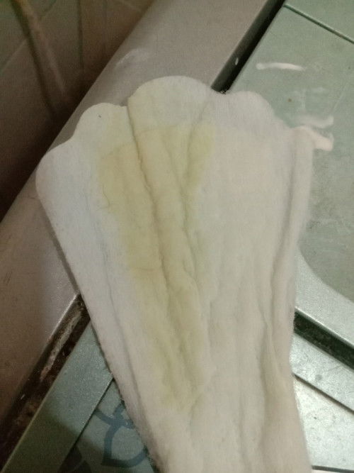 Ini cairan ketuban atau bukan?