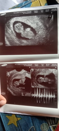 Laki ni baby