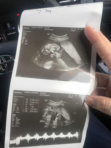 Tanda pregnant Baby Boy