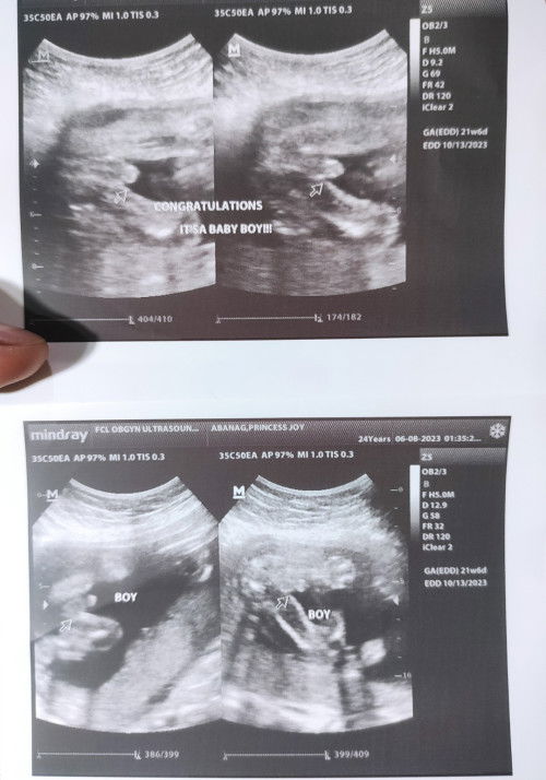 21W6D Gender Reveal🩵