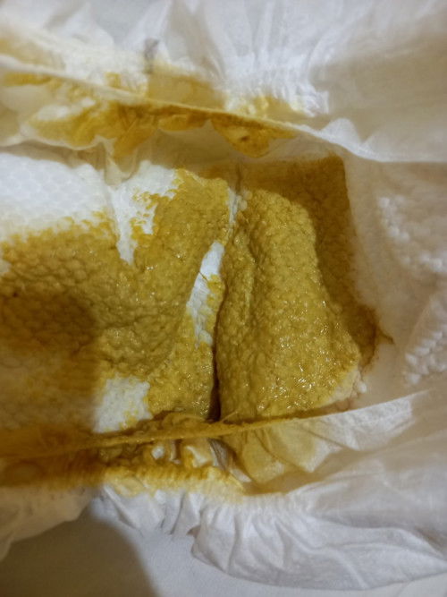 Ask  qo lng po sa 3 months old na baby normal Lang poba