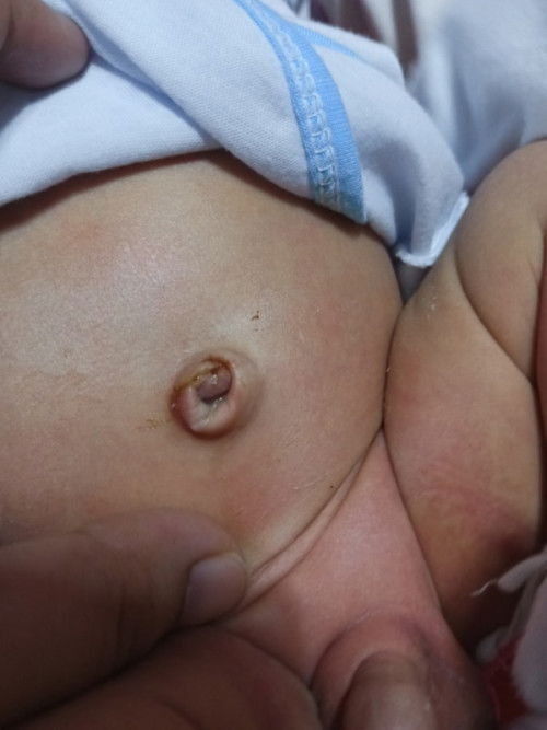 Pusod ni baby