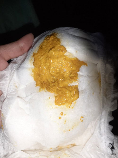 Warna feses bayi 2 bulan