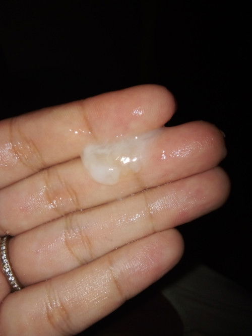 30weeks and 5days na Po ako preggy ano Po kaya tong lumabas sakin Ngayon na parang sipon??