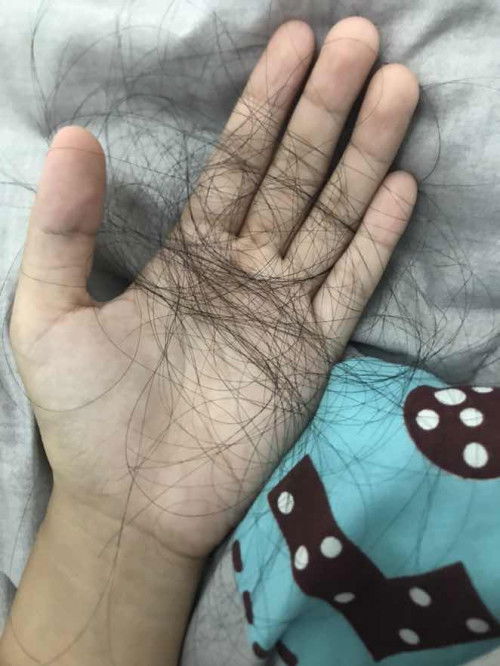 มีแม่ๆหลังคลอดคนไหนเป็นแบบนี้ไหมคะ