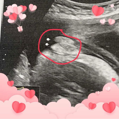 แบบนี้เพศหญิงหรือชายค่ะ แอบกังวล คนทักกับผลซาวไม่เหมือนกัน😂