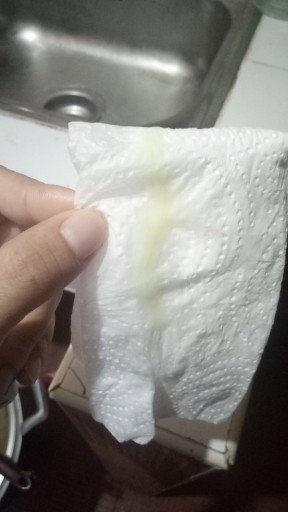 มีมูกแบบนี้จะคลอดไหมค่ะหรือเป็นแค่ตกขาว
