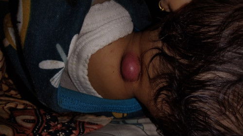 Mending periksa ke mana ya bun