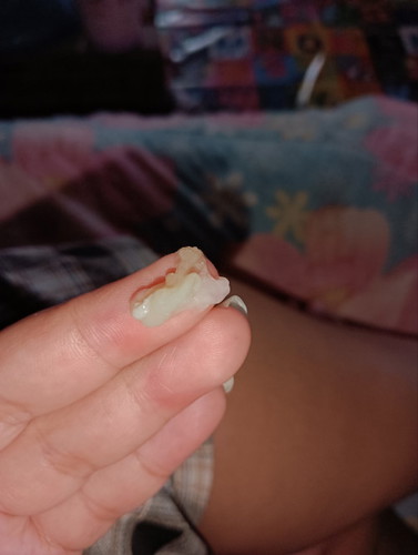 มันคืออะไรค่ะ