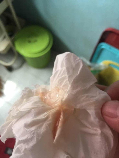 จะคลอดยังคะ