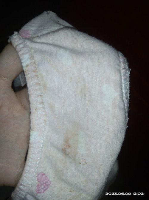 SPOTTING HINDI SIGURADO