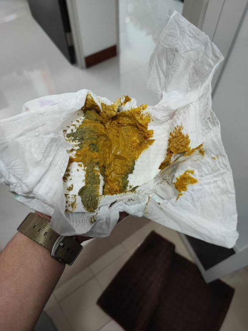 Baby poop greenish + yellow