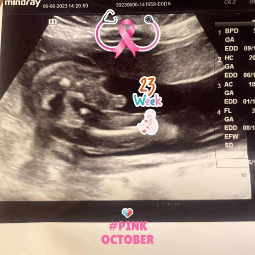 Baby First