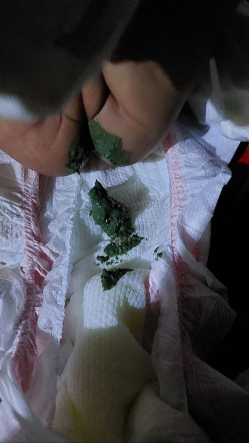 Normal lng po ba ang dark green na popo ni bb?