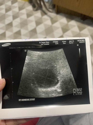 ท้อง6week 4d ซาวไม่เจอเด็ก