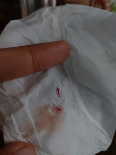Bun kalau keluar darah di kehamilan 8w sejak hptp dan juga baru keliatan kantung aja bahaya ga ? 😭