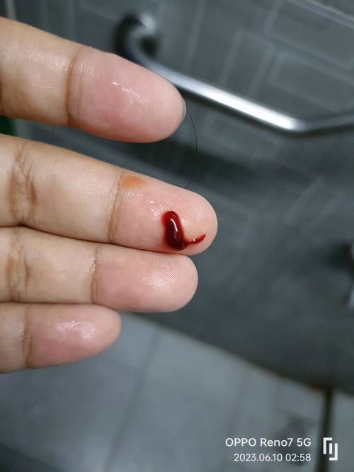 Ada darah ketika lepas buang air.apa tanda? Minggu 32 4hari