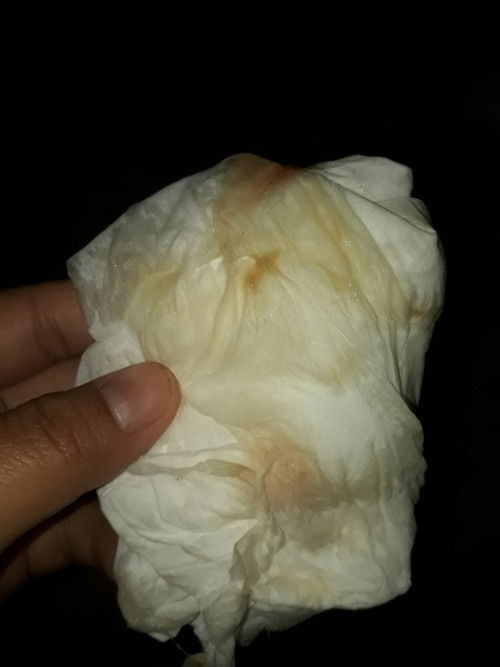 39+5มีมูกแบบนี้