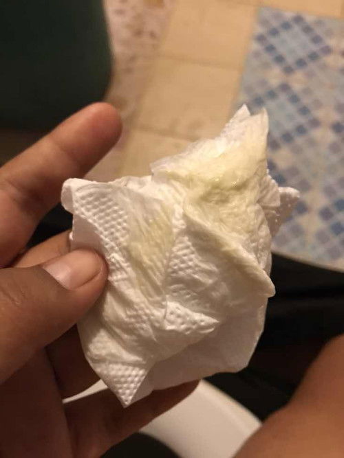 สอบถามแม่ๆค่ะ