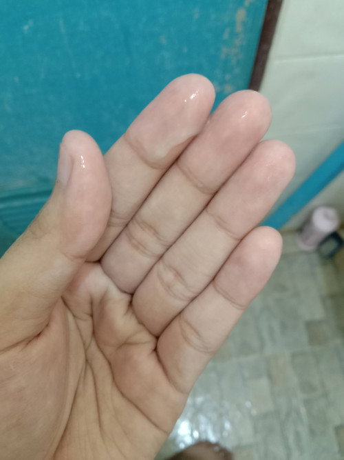 มีมูกออกเป็นจำนวนมาก