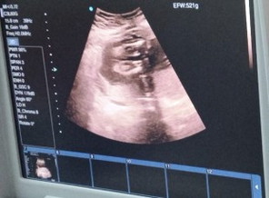 Gender ni Baby