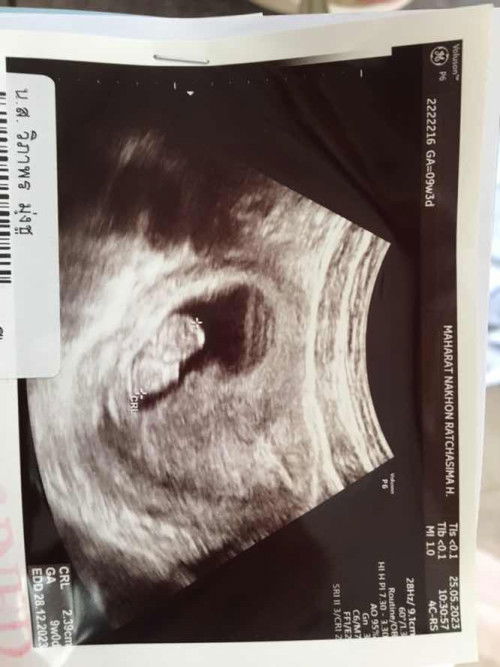 9 วีค / 2.39 cm น้องตามเกณฑ์ไหมคะ