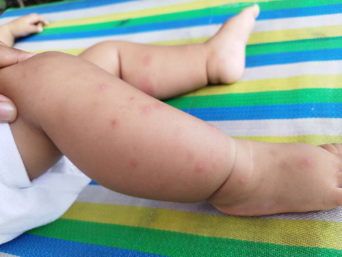 Lamok Tips for Babies