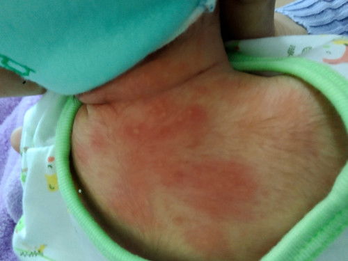 คลอดน้องวันที่7มิถุนายน