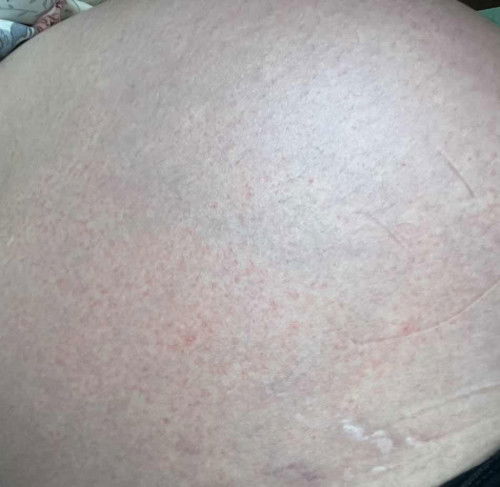 มีแม่ๆบ้านไหนเป็นแบบนี้ไหมคะ