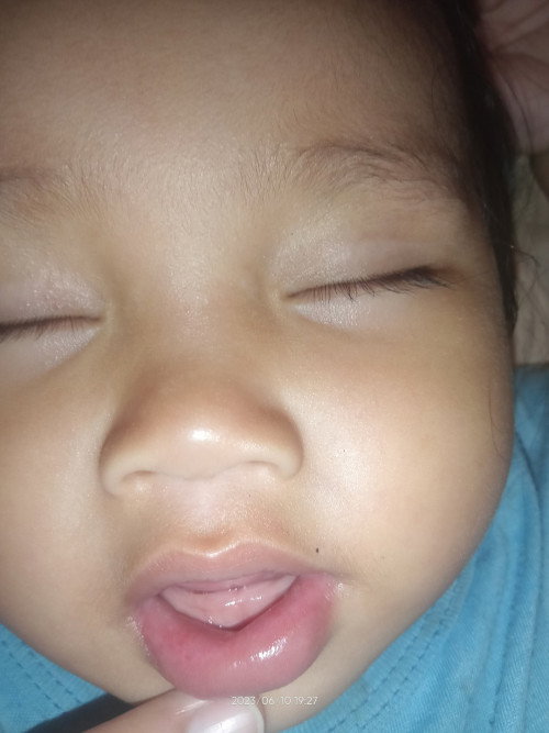 Tungkol sa pag ngingipin ni baby.