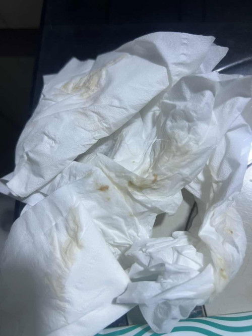 แบบนี้เรียกมูกเลือดไหมคะ