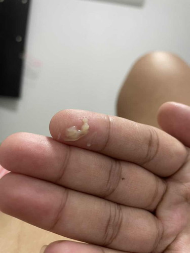 แบบนี้เรียกว่ามูกมั้ยคะ 39+3week