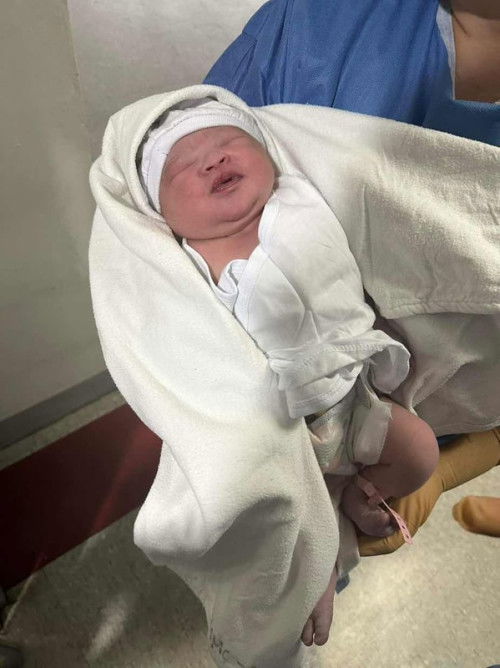 Normal Delivery with Epidural