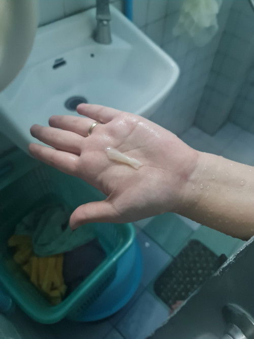 ผิดปกติไหมคะ