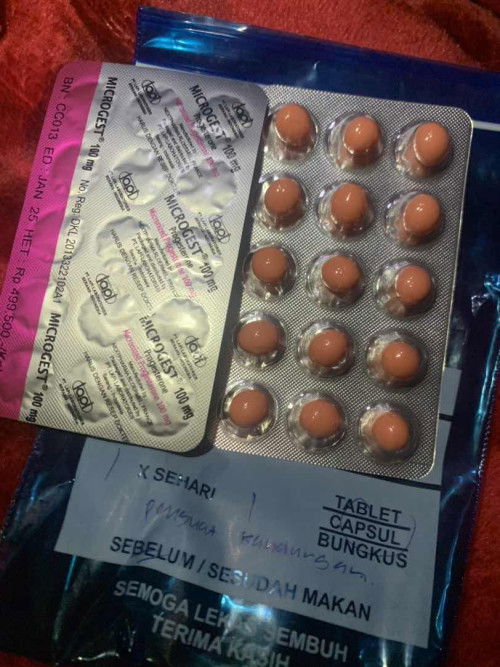 Janin tidak berkembang