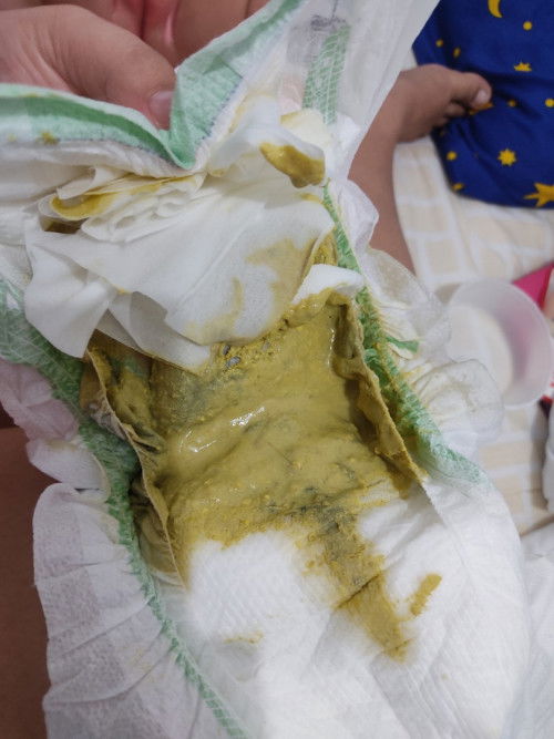 Green liquid poop of baby