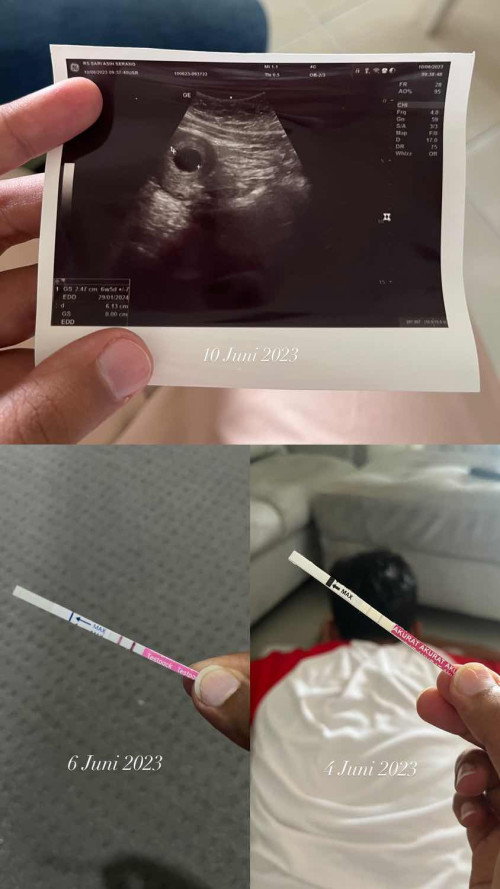 Positif hamil setelah sebelumnya hamil BO dan kuretase bulan Februari 2023 🥹