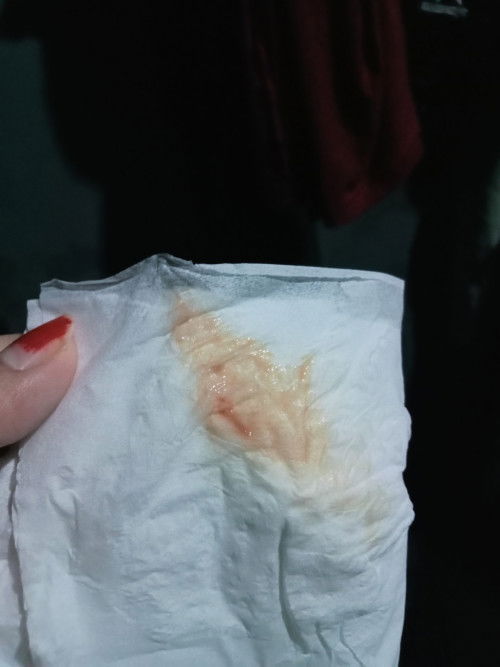 Pernah nggk Bun di Trimester 3 33minggu Keluar Kayak gini