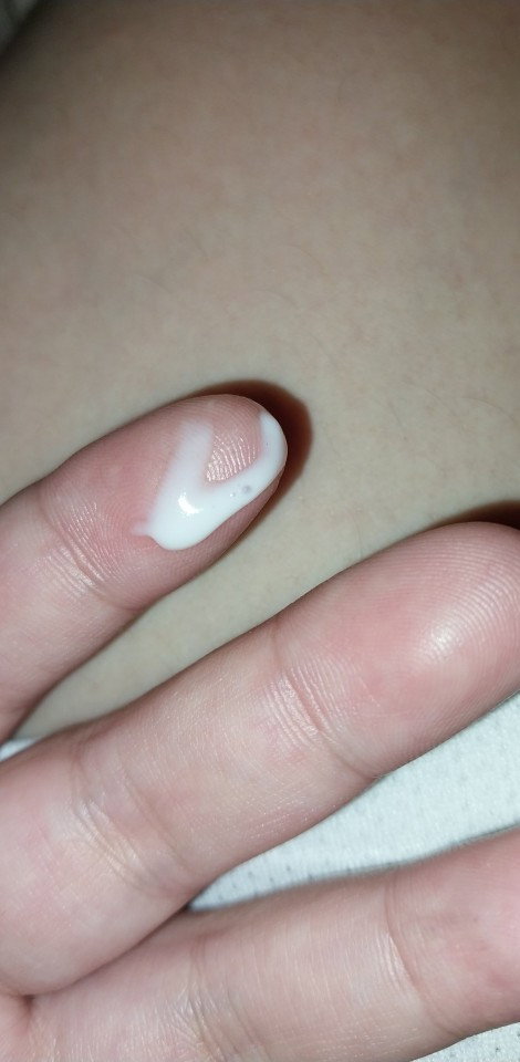Hello po mga mie ask ko lang po kong normal lang po itong lumabas sa pwerta ko 6months preggy po ako