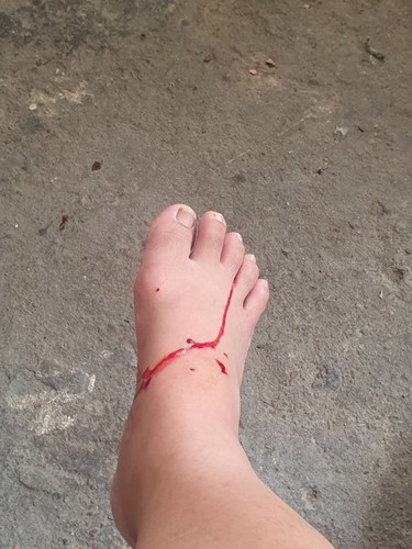 แมวกัดต้องทำไงคะ